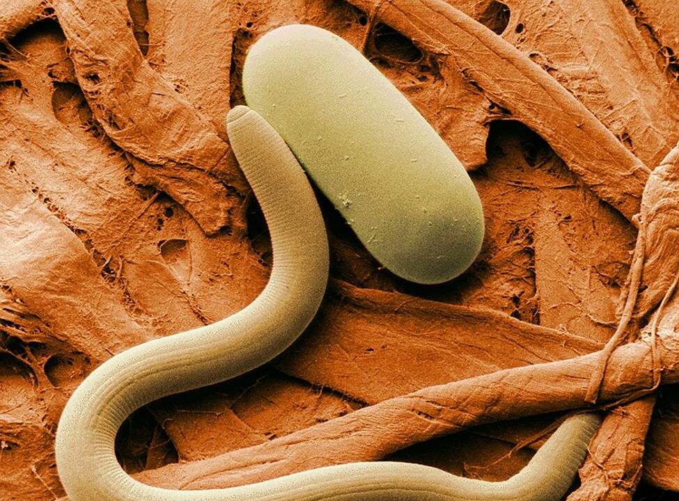 como se produce a infestación de vermes