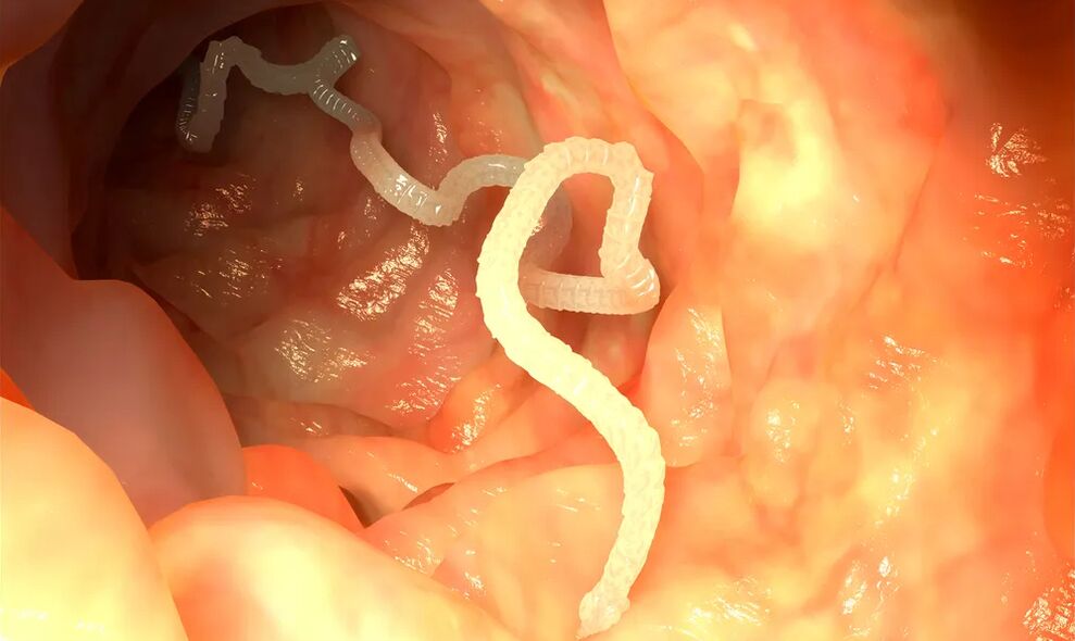 Os vermes luminais infectan os intestinos