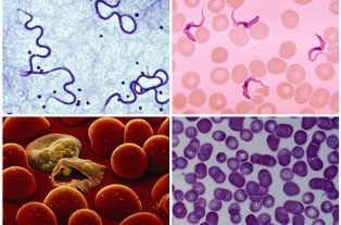 Que parasitos poden haber no sangue humano