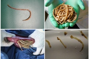 Que parasitos poden vivir no intestino humano